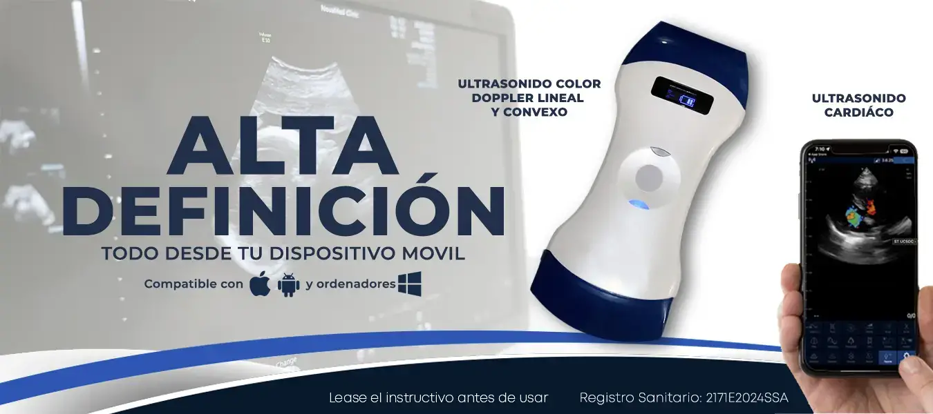 ULTRASONIDO